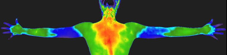 Medisinsk termografiskanning Smertefri og non-invasiv screening som endelig gjør kvantesprang i Europa.